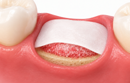 program